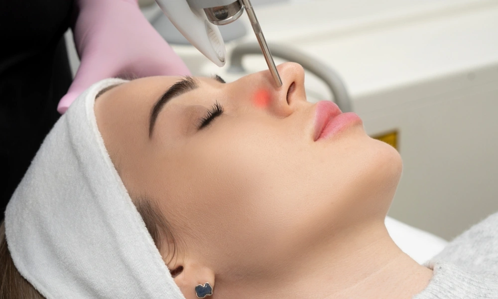 جوانسازی با لیزر فتونا چیست