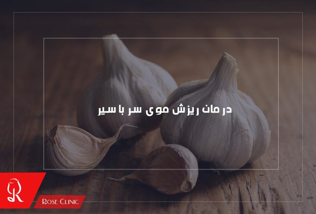 درمان ریزش مو