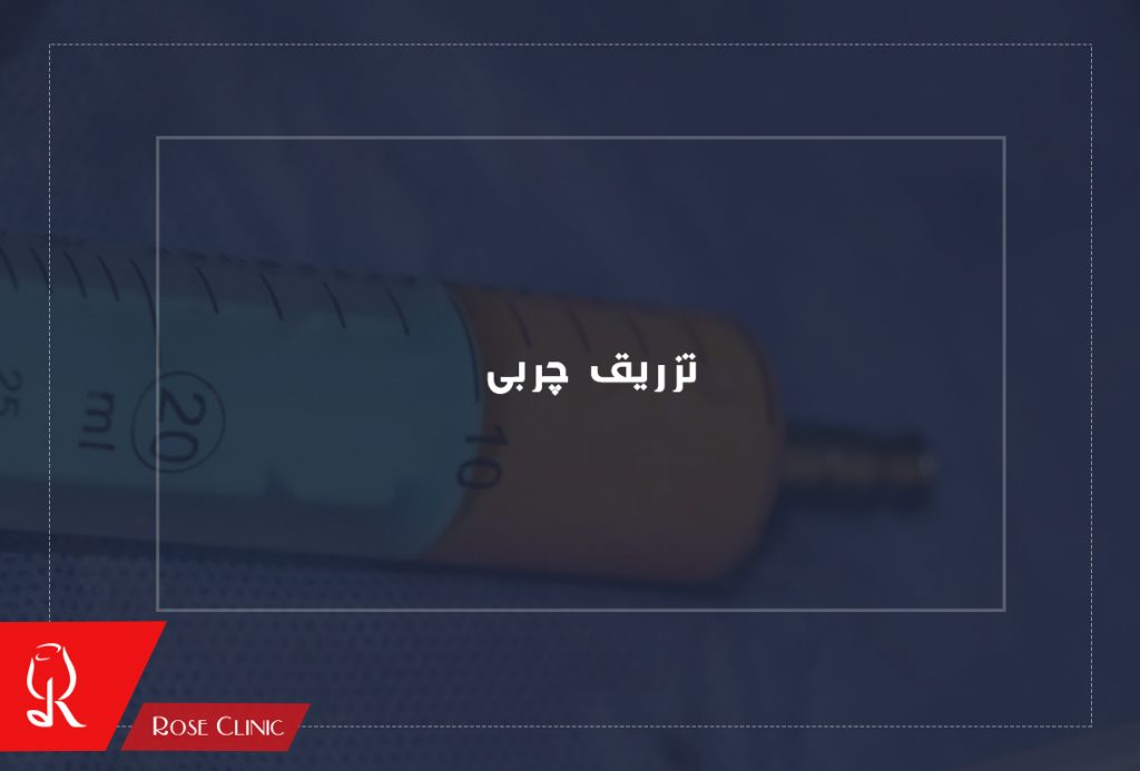 تزریق چربی به صورت