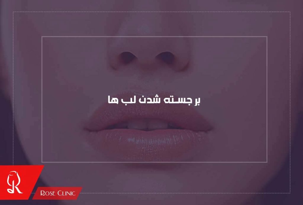 برجسته شدن لب ها