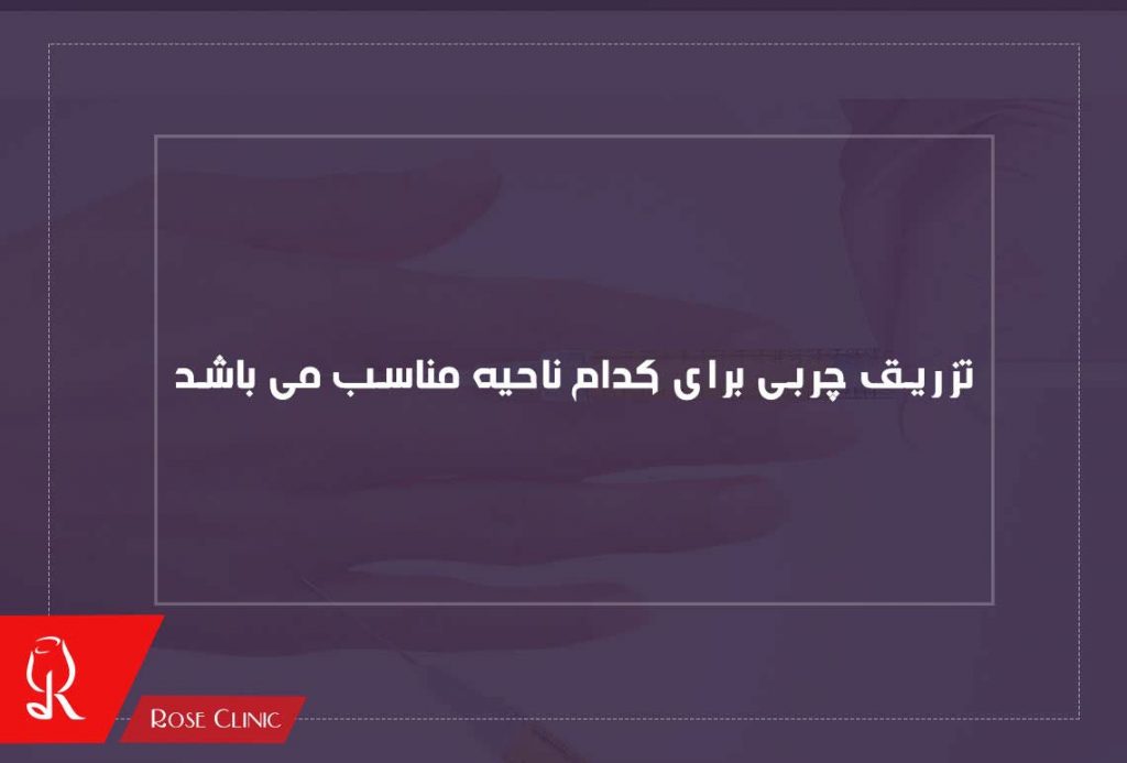 تزریق چربی برای کدام ناحیه