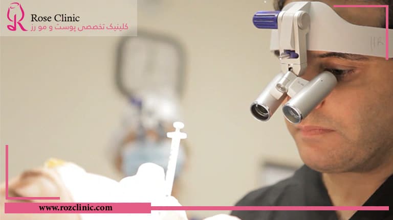 کاشت مو به روش ترکیبی