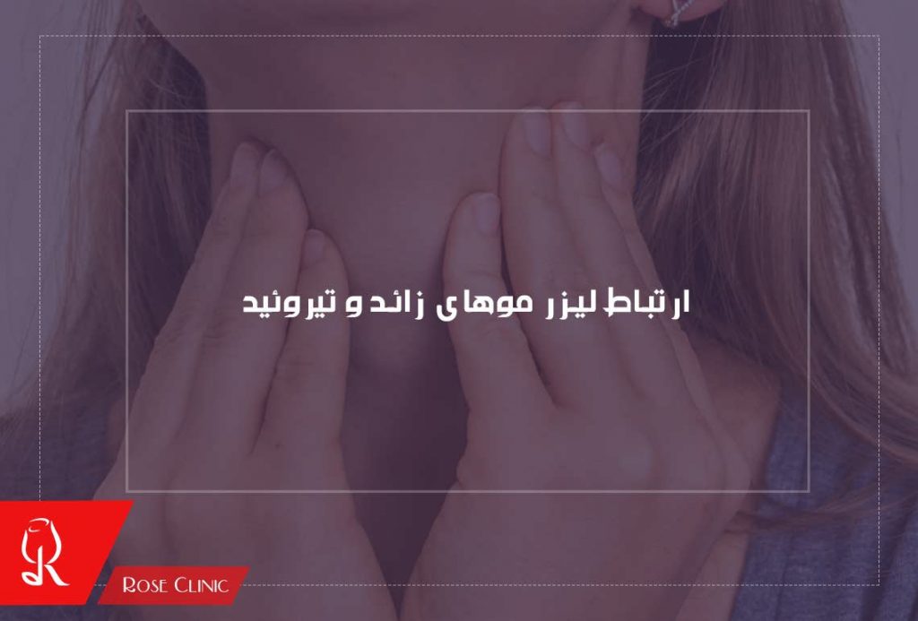 ارتباط لیزر موهای زائد و تیروئید
