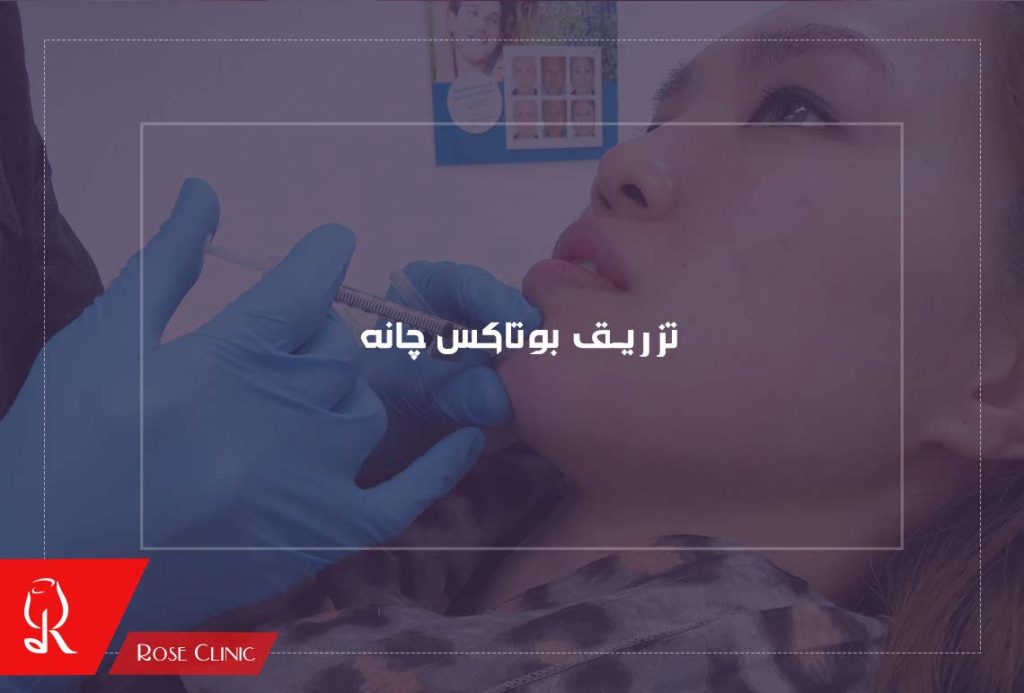 تزریق بوتاکس چانه