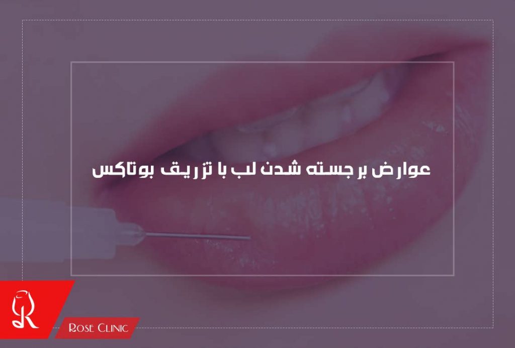 عوارض برجسته شدن لب با تزریق بوتاکس