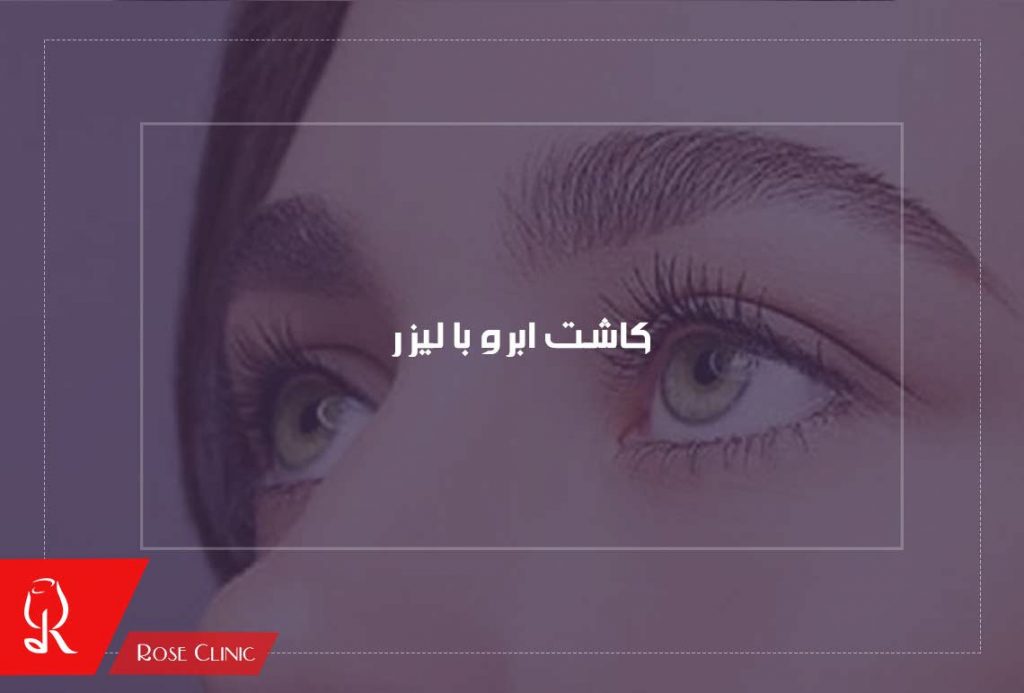 کاشت ابرو با لیزر