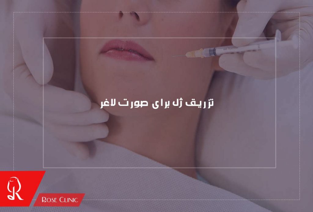 تزریق ژل برای صورت لاغر
