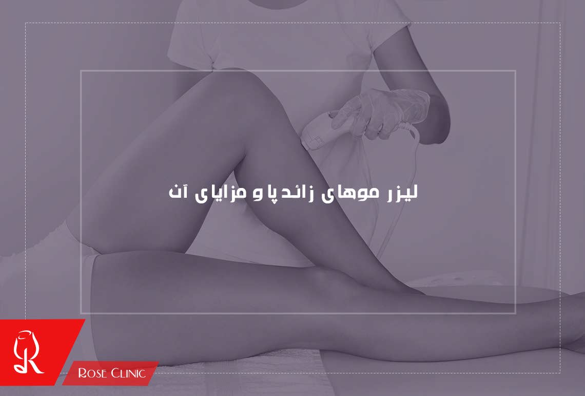 لیزر موهای زائد پا
