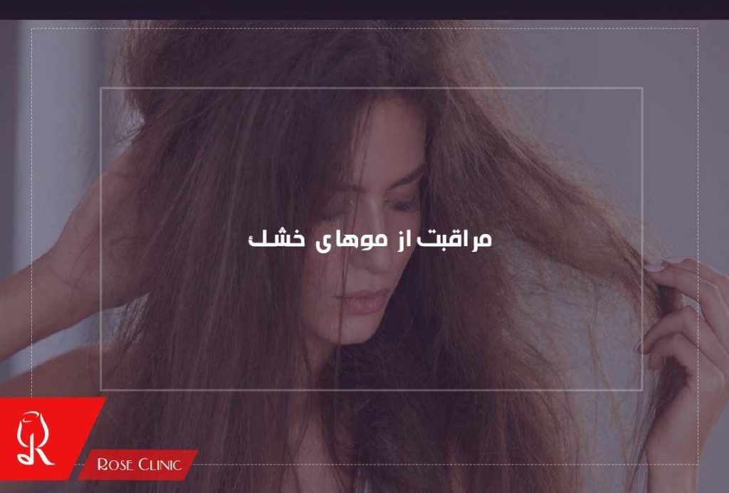 مراقبت از موهای خشک