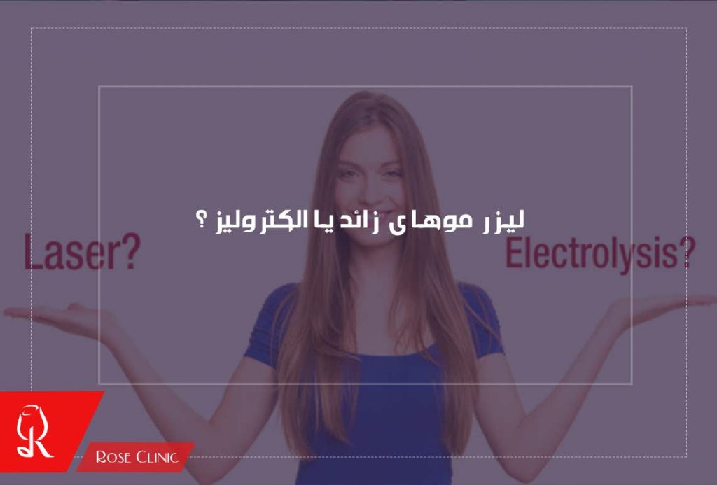 لیزر موهای زائد یا الکترولیز ؟