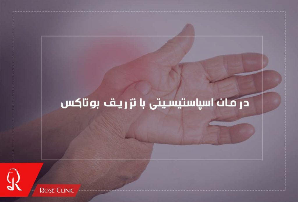 درمان اسپاستیسیتی با تزریق بوتاکس