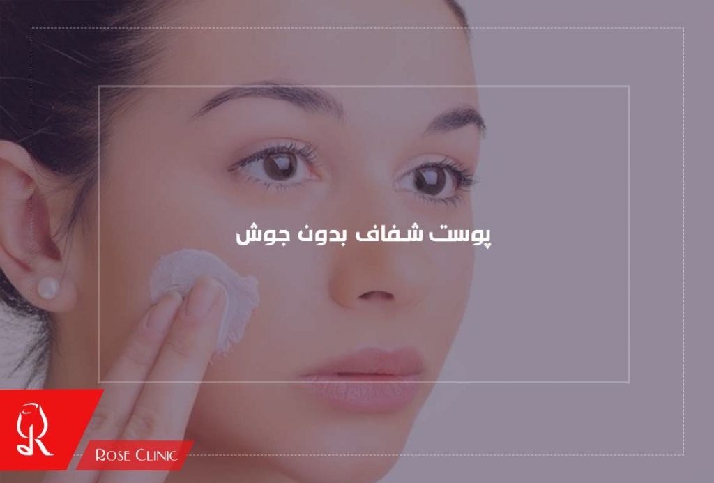 پوست شفاف بدون جوش