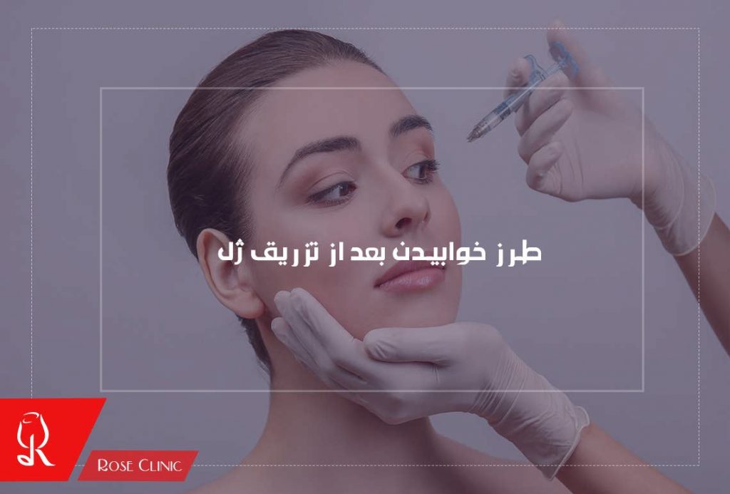 طرز خوابیدن بعد از تزریق ژل