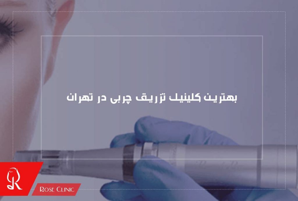 best-fat-injection-clinic-in-tehran