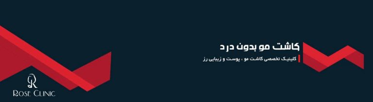 کاشت مو بدون درد