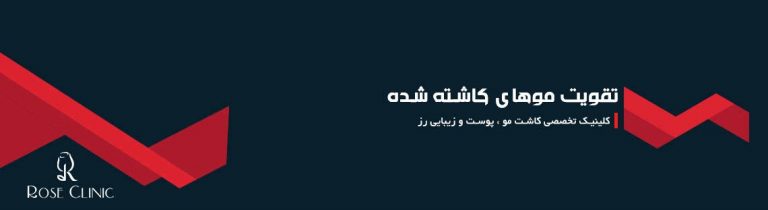 تقویت موهای کاشته شده