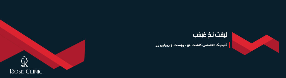 لیفت نخ غبغب