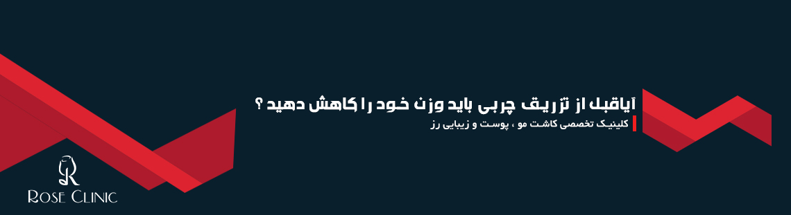 آیا قبل از تزریق چربی باید وزن خود را کاهش دهید