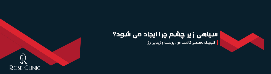 سیاهی زیر چشم چرا ایجاد می شود؟