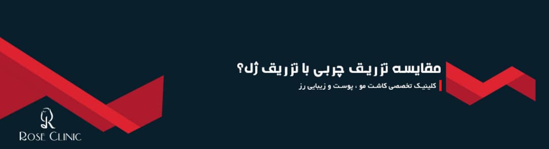 مقایسه تزریق چربی با تزریق ژل