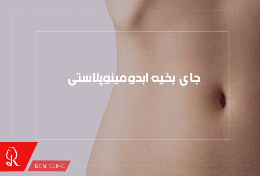 جای بخیه ابدومینوپلاستی