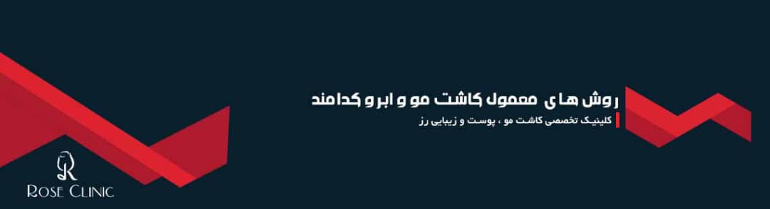 روش های معمول کاشت مو و ابرو کدامند؟