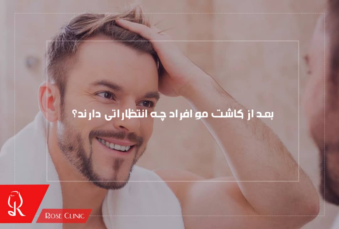 بعد از کاشت مو افراد چه انتظاراتی دارند؟