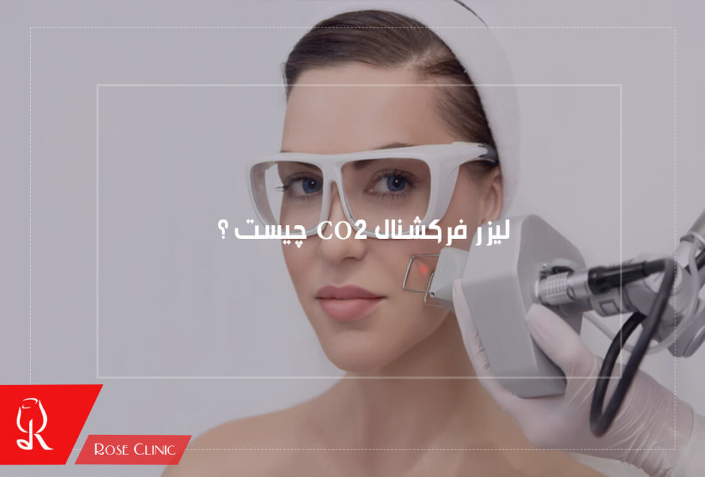 لیزر فرکشنال CO2 چیست