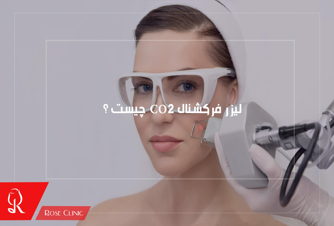 لیزر فرکشنال CO2 چیست