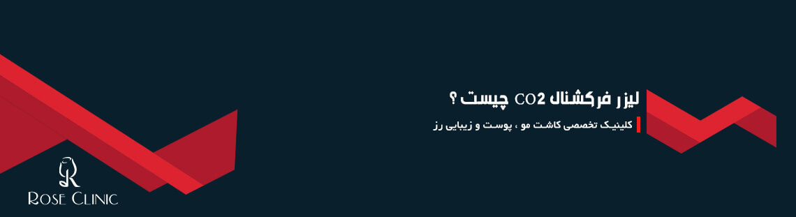 لیزر فرکشنال CO2 چیست