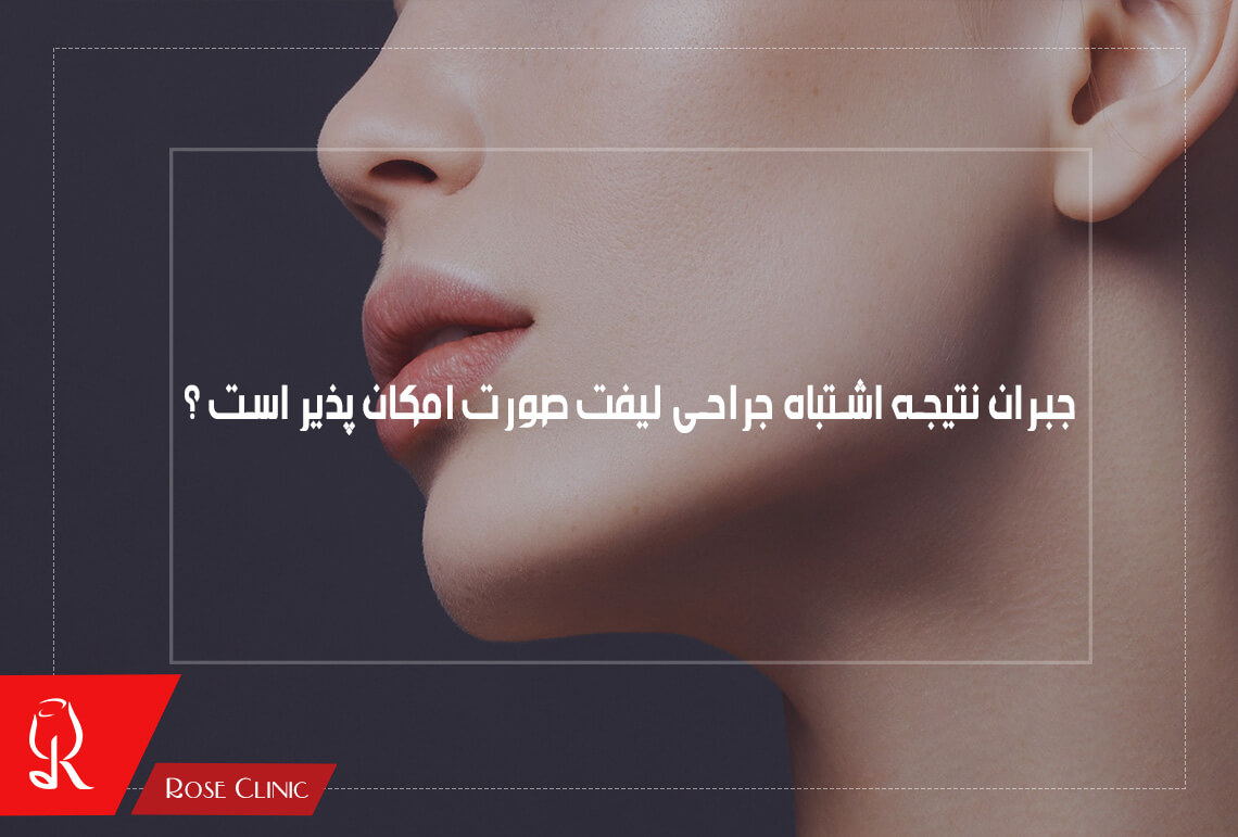 جبران نتیجه اشتباه جراحی لیفت صورت امکان پذیر است