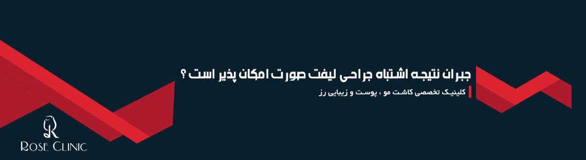 جبران نتیجه اشتباه جراحی لیفت صورت امکان پذیر است