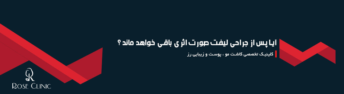 آیا پس از جراحی لیفت صورت اثری باقی خواهد ماند