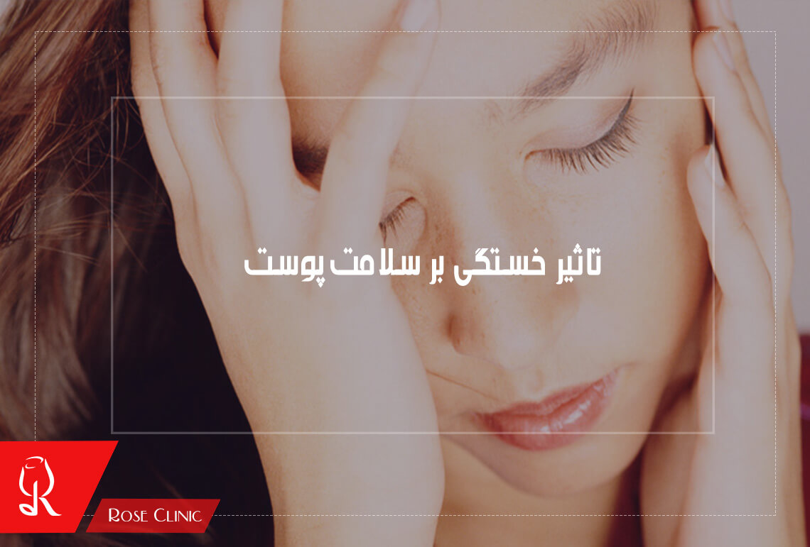 تاثیر خستگی بر سلامت پوست