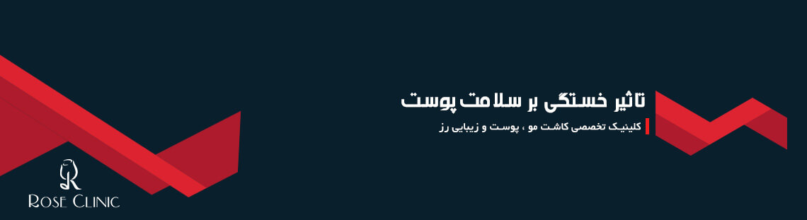 تاثیر خستگی بر سلامت پوست