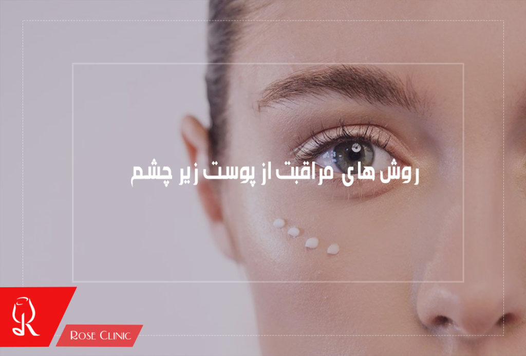 روش های مراقبت از پوست زیر چشم