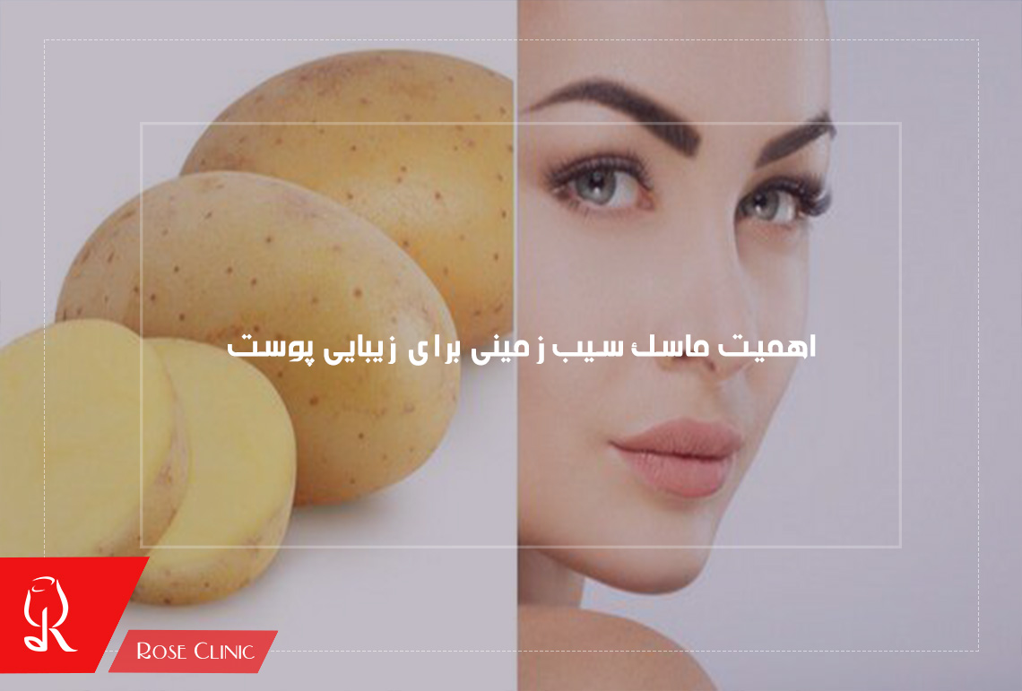 اهمیت ماسک سیب زمینی برای زیبایی پوست