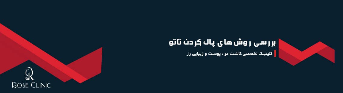 بررسی روش های پاک کردن تاتو