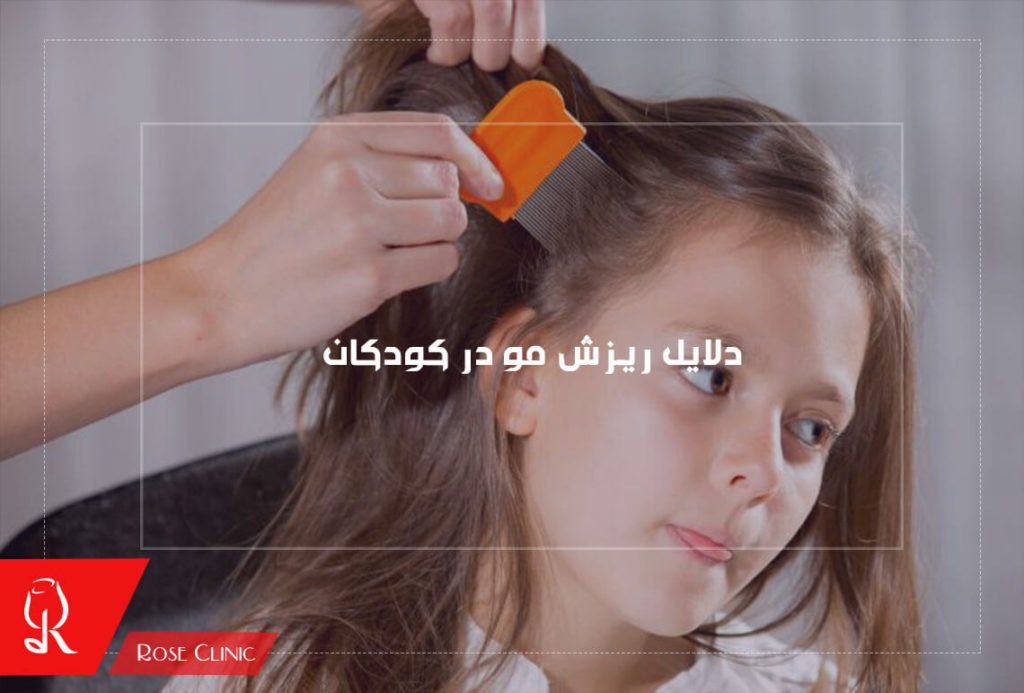 دلایل ریزش مو در کودکان چیست