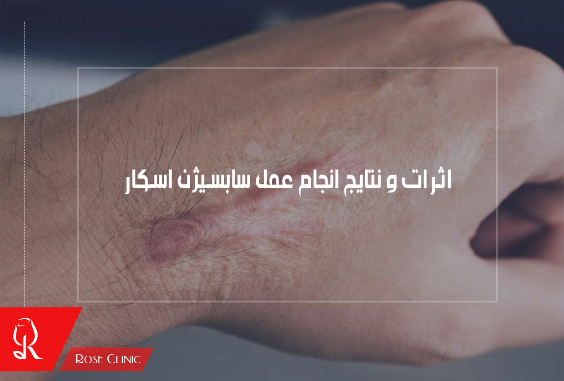 اثرات و نتایج انجام عمل سابسیژن اسکار