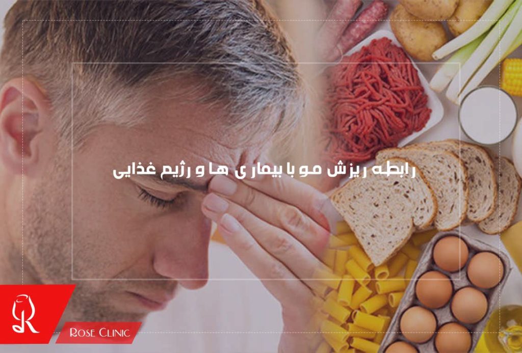رابطه ریزش مو با بیماری ها و رژیم غذایی