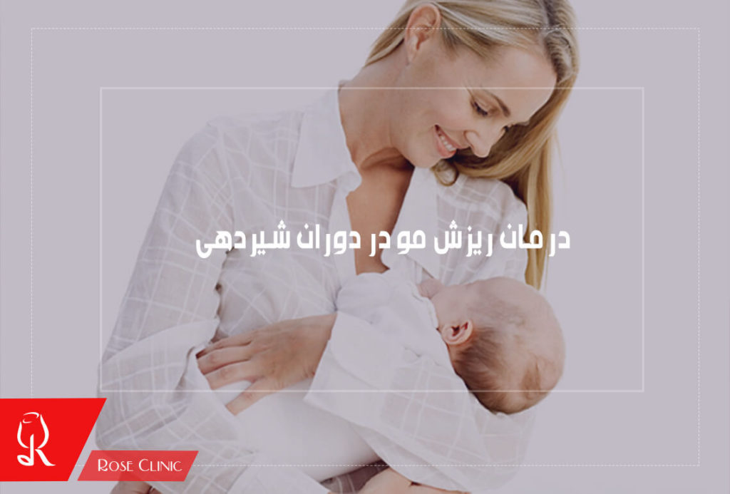 درمان ریزش مو در دوران شیردهی