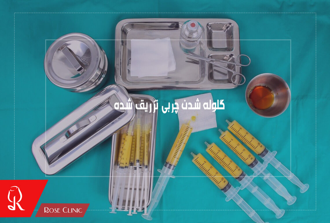 گلوله شدن چربی تزریق شده