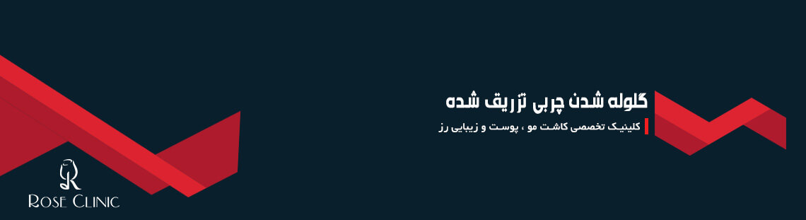 گلوله شدن چربی تزریق شده