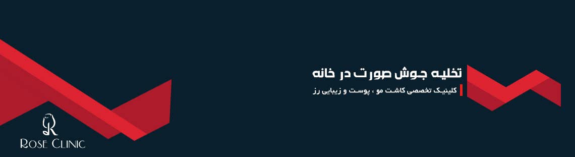 تخلیه جوش صورت در خانه