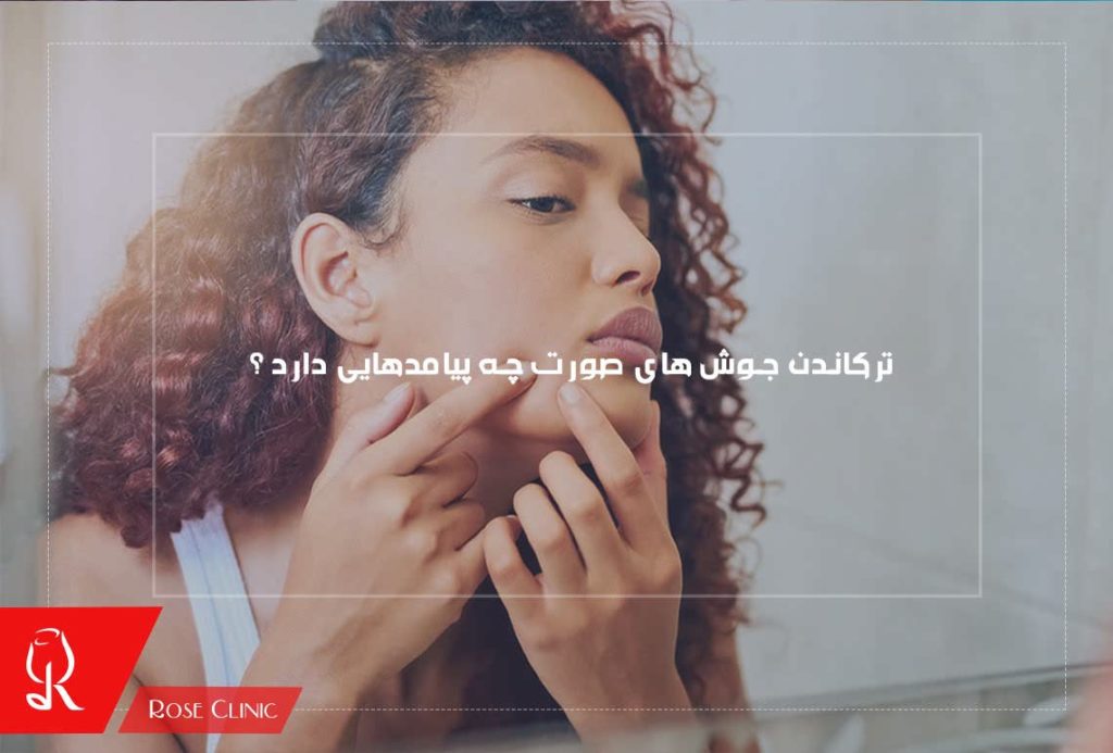 تخلیه جوش صورت در خانه