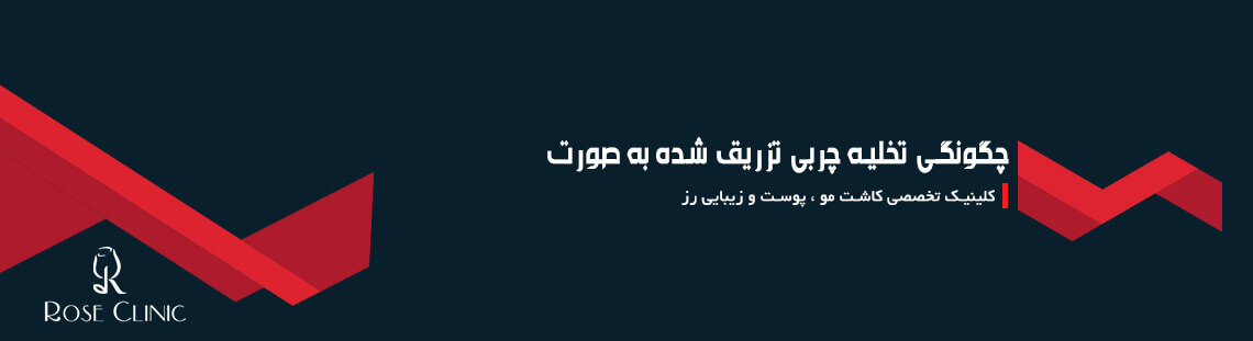 چگونگی تخلیه چربی تزریق شده به صورت