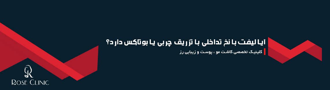 آیا لیفت با نخ تداخلی با تزریق چربی یا بوتاکس دارد؟