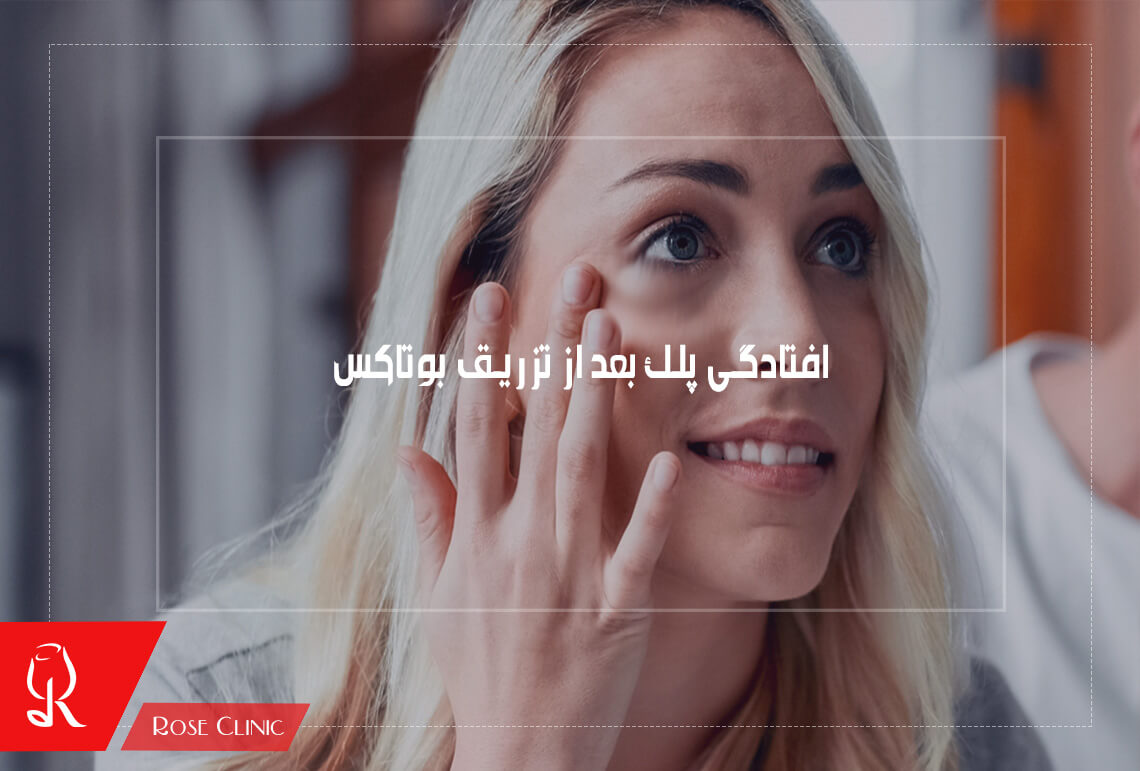 افتادگی پلک بعد از تزریق بوتاکس