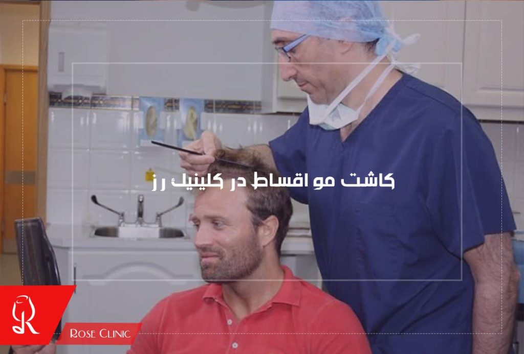 کاشت مو اقساط در کلینیک رز
